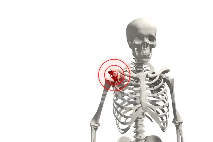 3D illustration, shoulder painful skeleton, medical concept.