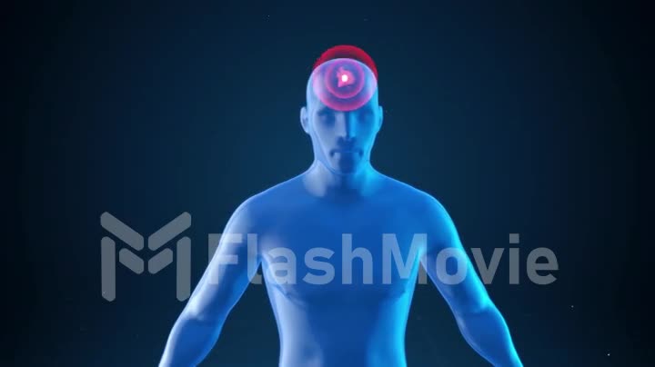 Model of a man with impulses of a headache, medical concept